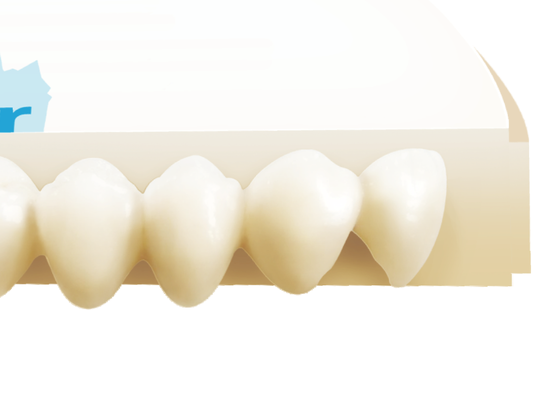 Mastering Multilayer Zirconia Disc Nesting: Positioning for Accurate ...